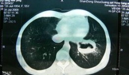ct最新活动爆料